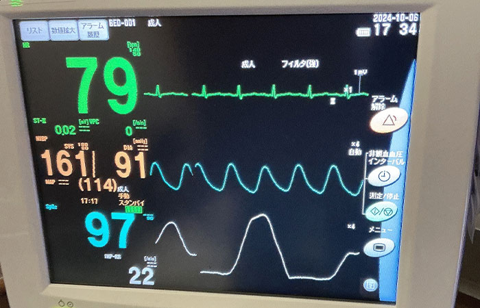 生体情報モニター