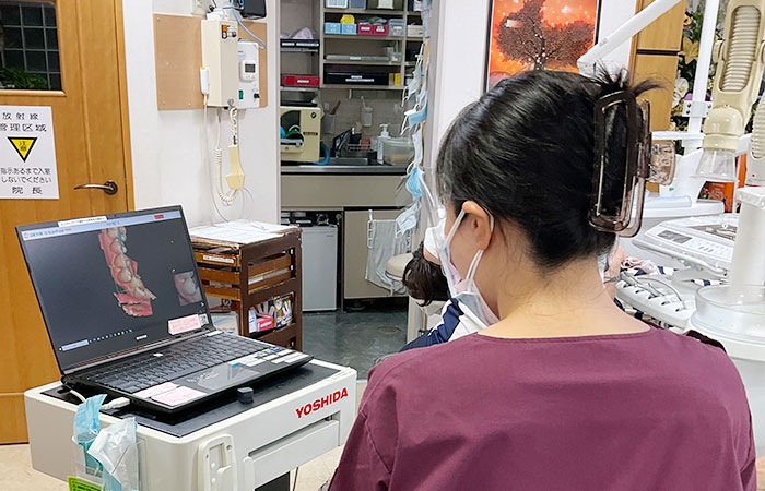 口腔内スキャナー