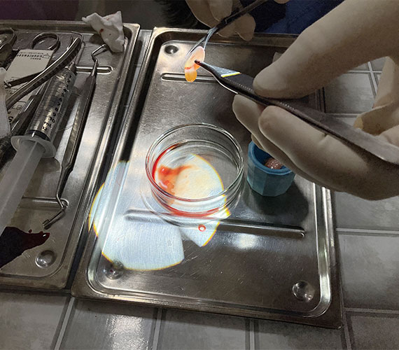 組織の再生を促す成長因子？