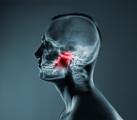 顎関節症　