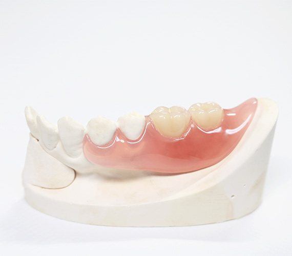 「見た目」も「機能」も◎な自由診療の入れ歯
